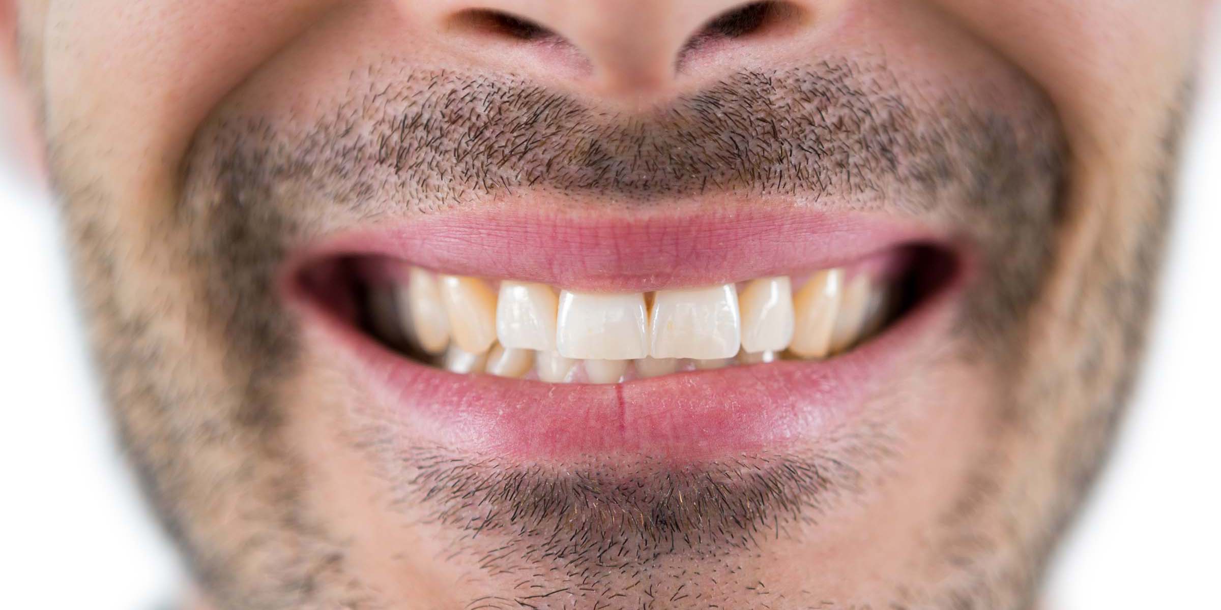 man-showing-his-teeth3-YUFNXWG.jpg man-showing-his-teeth3-YUFNXWG.jpg